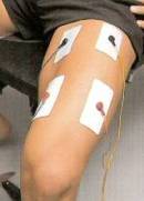 electrostimulation-quadriceps
