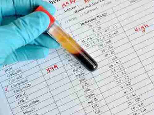 analyse cholesterol