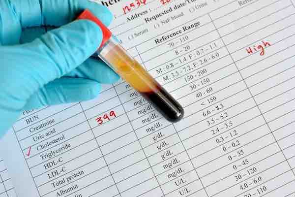 taux cholesterol