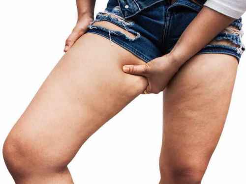 comment perdre la cellulite des cuisses